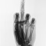 Xray